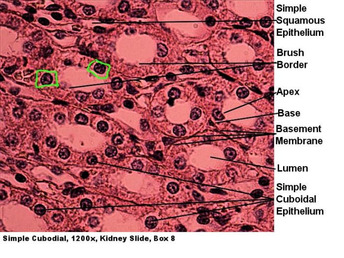 Renal corpuscle juxtaglomerular glomerulus kidney densa mesangial macula apparatus glomerular anatomy bowman mesangium function tubule glomerulonephritis membrane histology basement proliferative